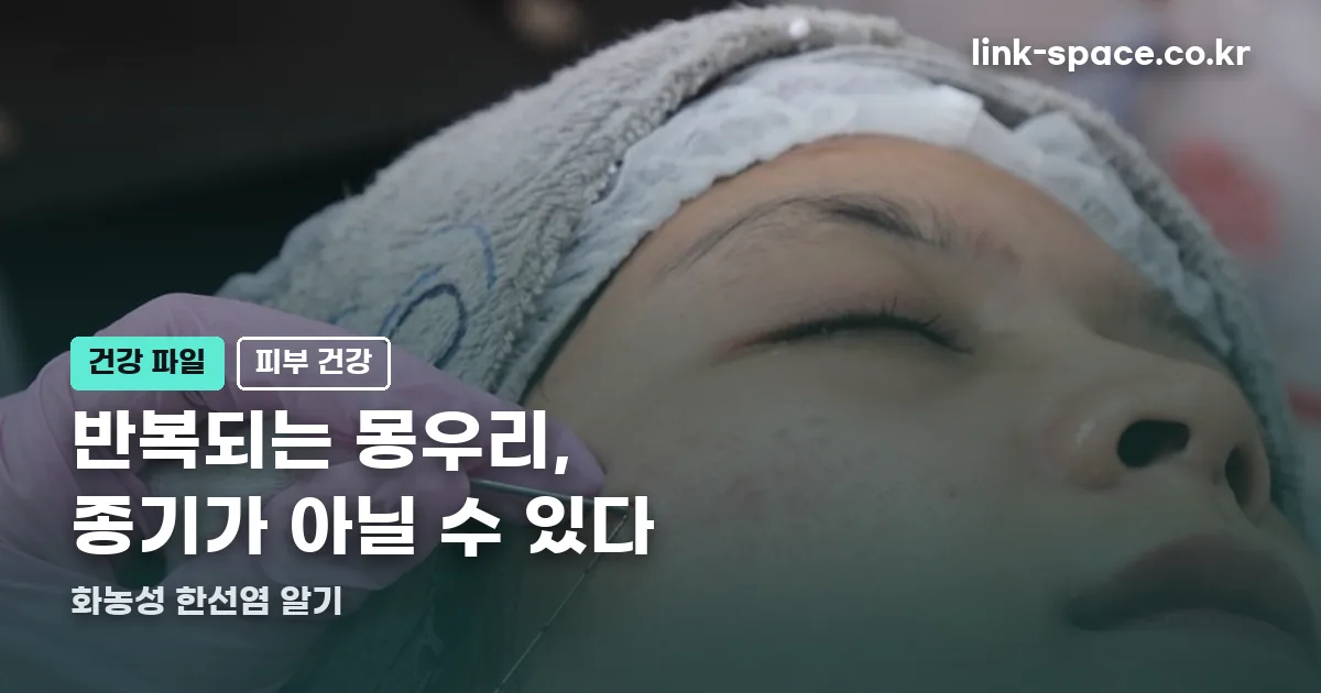 화농성 한선염 정리 썸네일