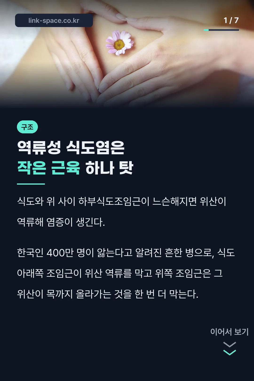 역류성 식도염 개념 소개